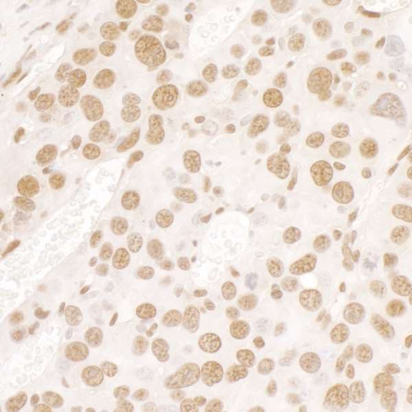 FUS / TLS Antibody (aa1-50)
