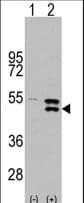 MAP2K5 / MEK5 Antibody (Ser149)