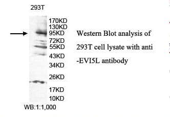 Polyclonal Rabbit anti-Human EVI5L Antibody (aa642-794, IHC, WB)
