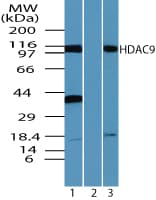 HDAC9 Antibody (aa100-150)