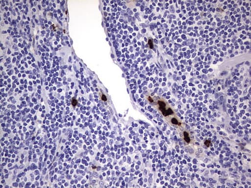 Monoclonal Mouse anti-Human CEACAM5 / CD66e Antibody (clone OTI3D8, aa35-680, IHC, WB)