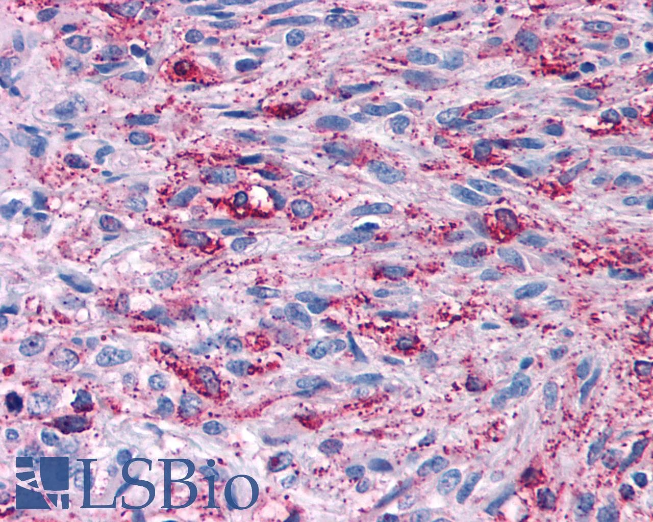 PathPlus™ CELSR2 Antibody (N-Terminus)