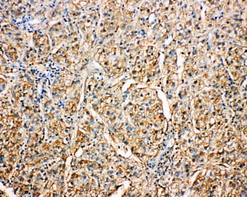 SERPINA4 / Kallistatin Antibody (aa384-401)