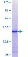 Human PS20 / WFDC1 Protein (Recombinant GST, N-terminus)