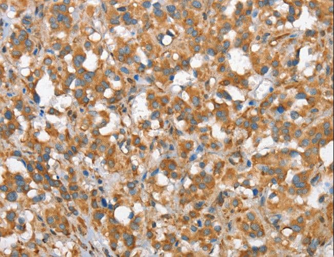 CSMD1 Antibody