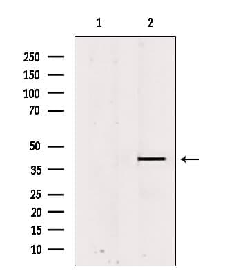 Polyclonal Rabbit anti-Human PSAT1 Antibody (IHC, IF, WB)