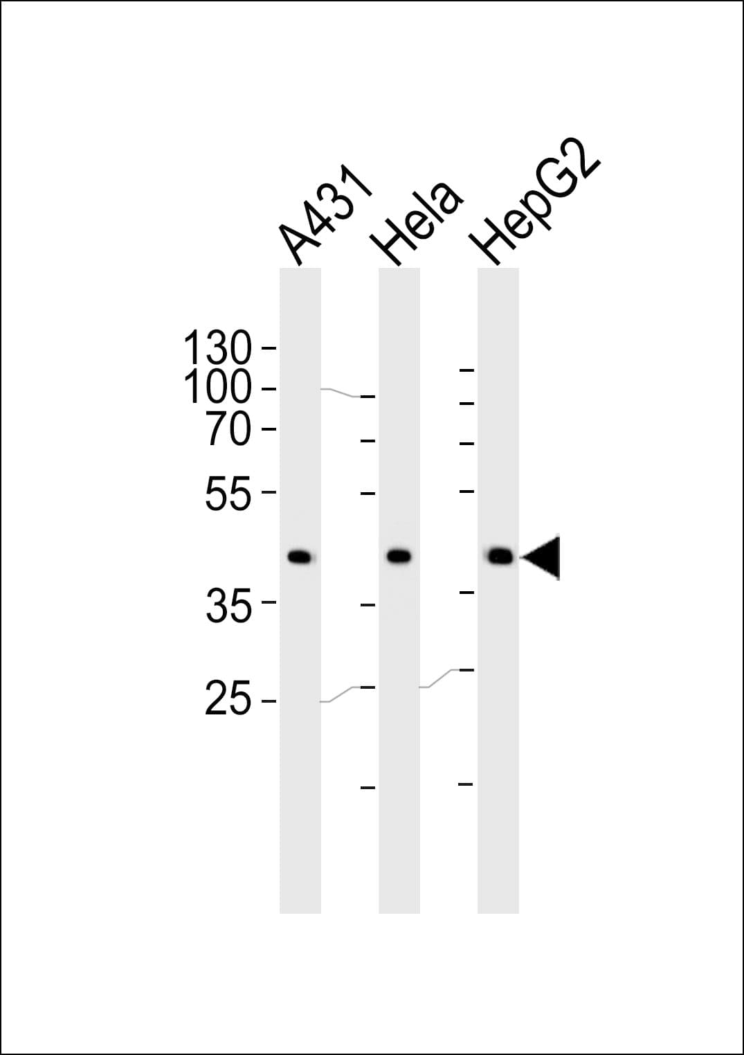CSNK2A1 Antibody (aa250-284)