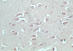 Polyclonal Rabbit anti-Human S1PR5 / EDG8 / S1P5 Antibody (IHC, WB)