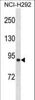 FACL2 / ACSL1 Antibody (aa505-533)