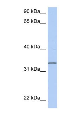 C3orf62 Antibody (aa179-228)