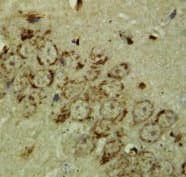 GRIN1 / NMDAR1 Antibody (N-Terminus)