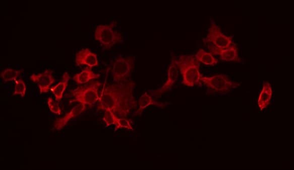 GABBR1 / GABA B Receptor 1 Antibody