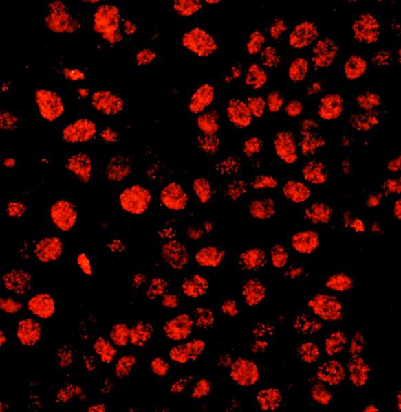 Polyclonal Rabbit anti-Human TIMELESS Antibody (aa1170-C-term, IHC, WB)