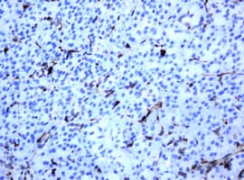 Monoclonal Mouse anti-Human TP / Thymidine Phosphorylase Antibody (clone OTI1H10, IHC, WB)