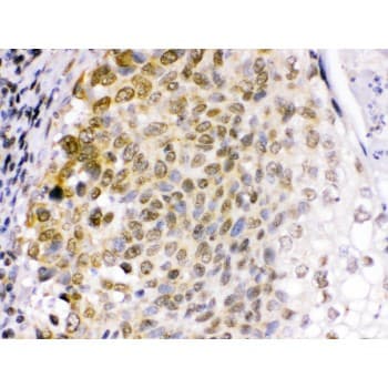 Polyclonal Rabbit anti-Human EME1 Antibody (aa520-561, IHC, WB)