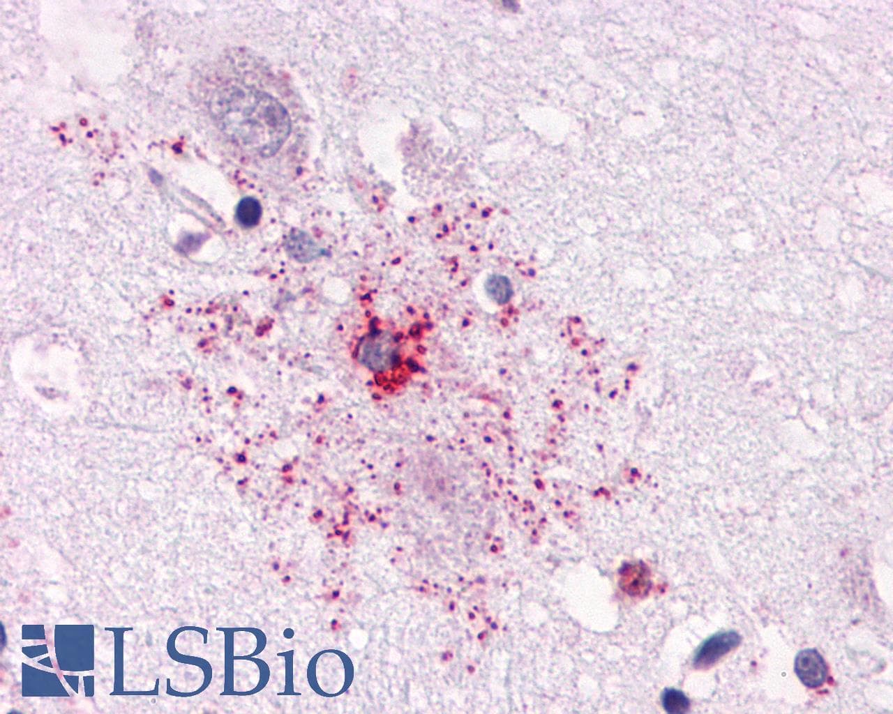 PathPlus™ APLNR/ Apelin Receptor / APJ Antibody (Cytoplasmic Domain)