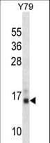 PFN2 / Profilin 2 Antibody (aa110-139)