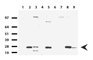 KLK8 / Kallikrein 8 Antibody (clone UMAB84, Carrier-free)