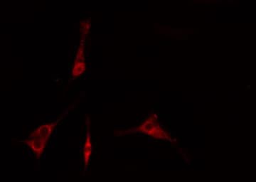Polyclonal Rabbit anti-Human IRAK2 / IRAK-2 Antibody (IF, WB)