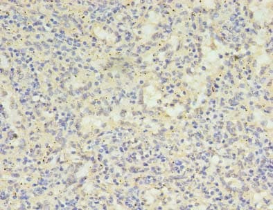 SH3BGRL Antibody