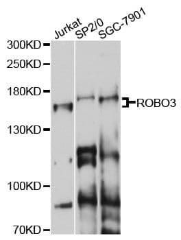 ROBO3 Antibody