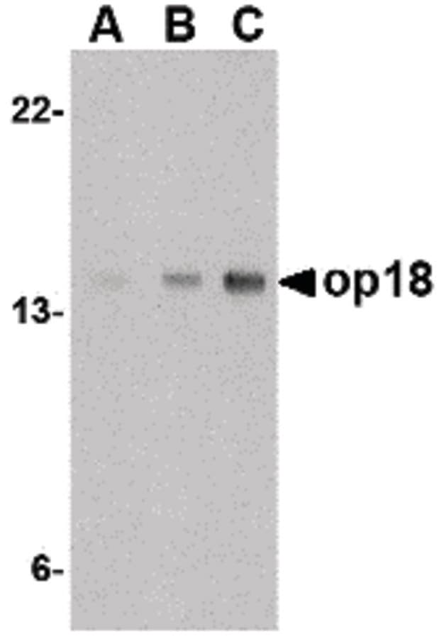 IHC-plus™ Polyclonal Rabbit anti-Human STMN1 / Stathmin / LAG Antibody (IHC, IF, WB)