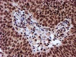 Monoclonal Mouse anti-Human RFXANK Antibody (clone OTI2B6, IHC, IF, WB)