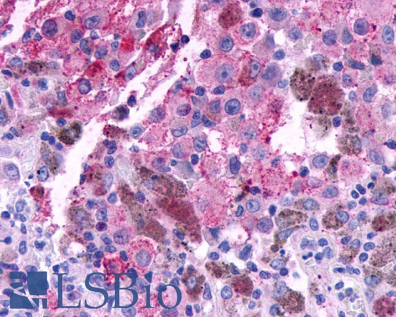 IHC-plus™ Polyclonal Rabbit anti-Human CRHR2 / CRF2 Receptor Antibody (N-Terminus, IHC)