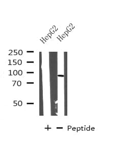 CPT1A Antibody