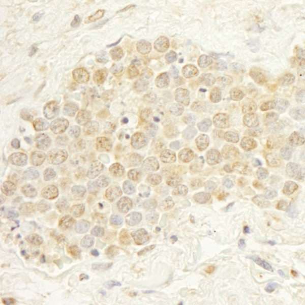 WDR20 Antibody (aa450-500)