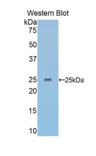SPTAN1 / Alpha Fodrin Antibody (aa1605-1806)