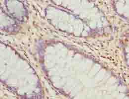 ARMT1 Antibody