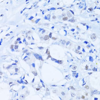 PARP1 Antibody