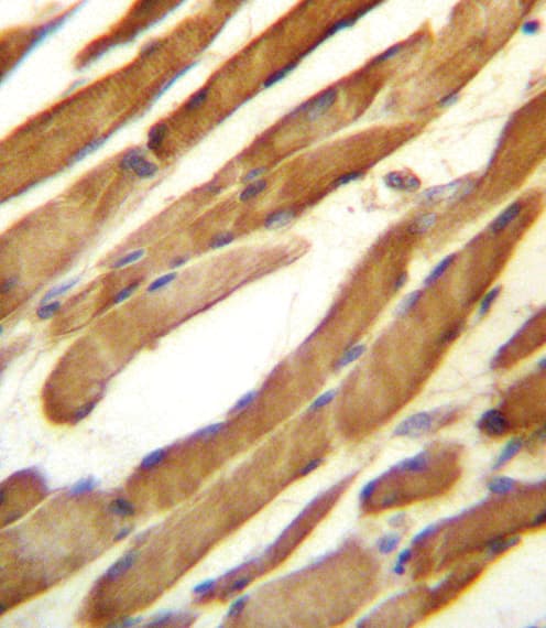 Polyclonal Rabbit anti-Human SLC16A10 Antibody (aa301-329, IHC, WB)