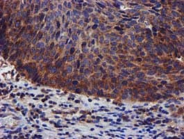PIH1D2 Antibody (clone OTI4A10)