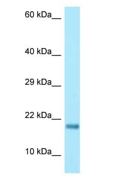 Polyclonal Rabbit anti-Human RPS17 / Ribosomal Protein S17 Antibody (aa65-114, WB)