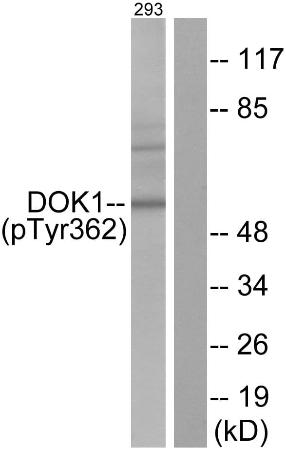 Polyclonal Rabbit anti-Human DOK1 Antibody (phospho-Tyr362, WB)