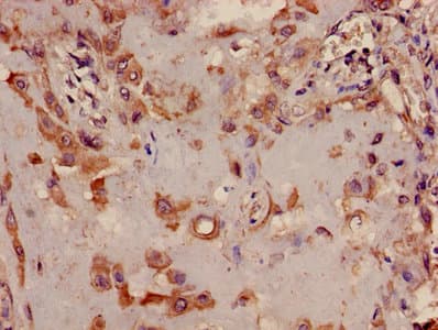 TRIB2 Antibody