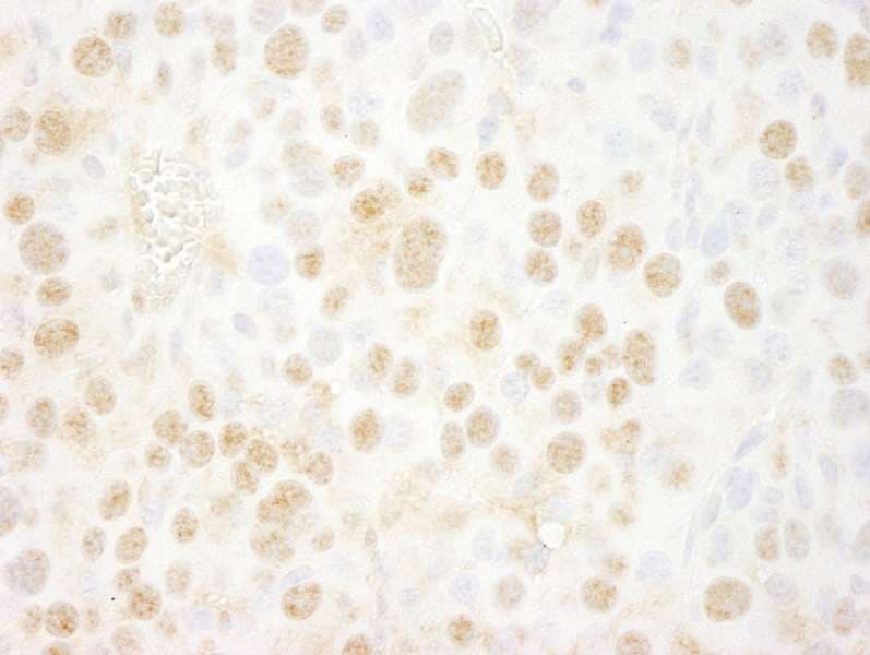 BMI1 / PCGF4 Antibody (aa276-326)