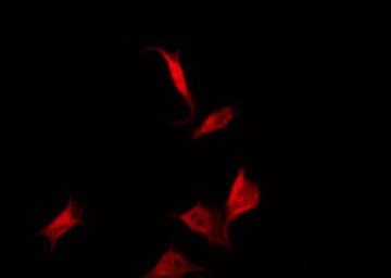 CYB561D2 Antibody