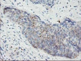 SPINT1 / HAI-1 Antibody (clone OTI1E2)