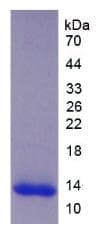 Human ADAMTS8 Protein (Recombinant His)