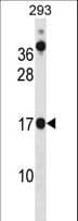Polyclonal Rabbit anti-Human CHCHD10 Antibody (aa1-30, WB)