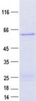 Human DDX31 Protein (Recombinant His, N-Terminal)