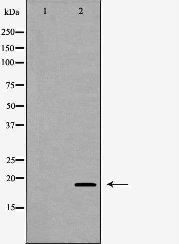 Polyclonal Rabbit anti-Human GTF2A1 / TFIIA Antibody (IHC, IF, WB)