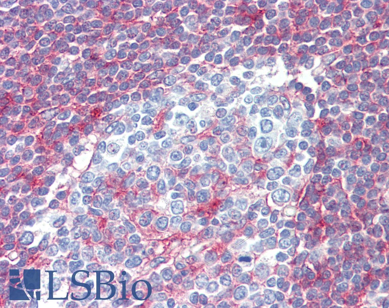 IHC-plus™ NT5E / eNT / CD73 Antibody (clone 1D7)