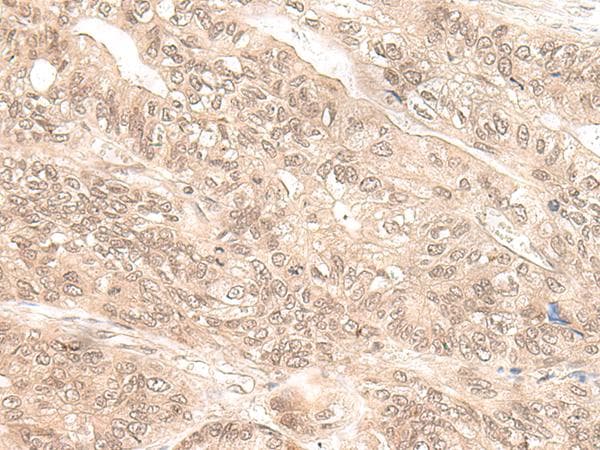 EXOSC9 / p5 Antibody