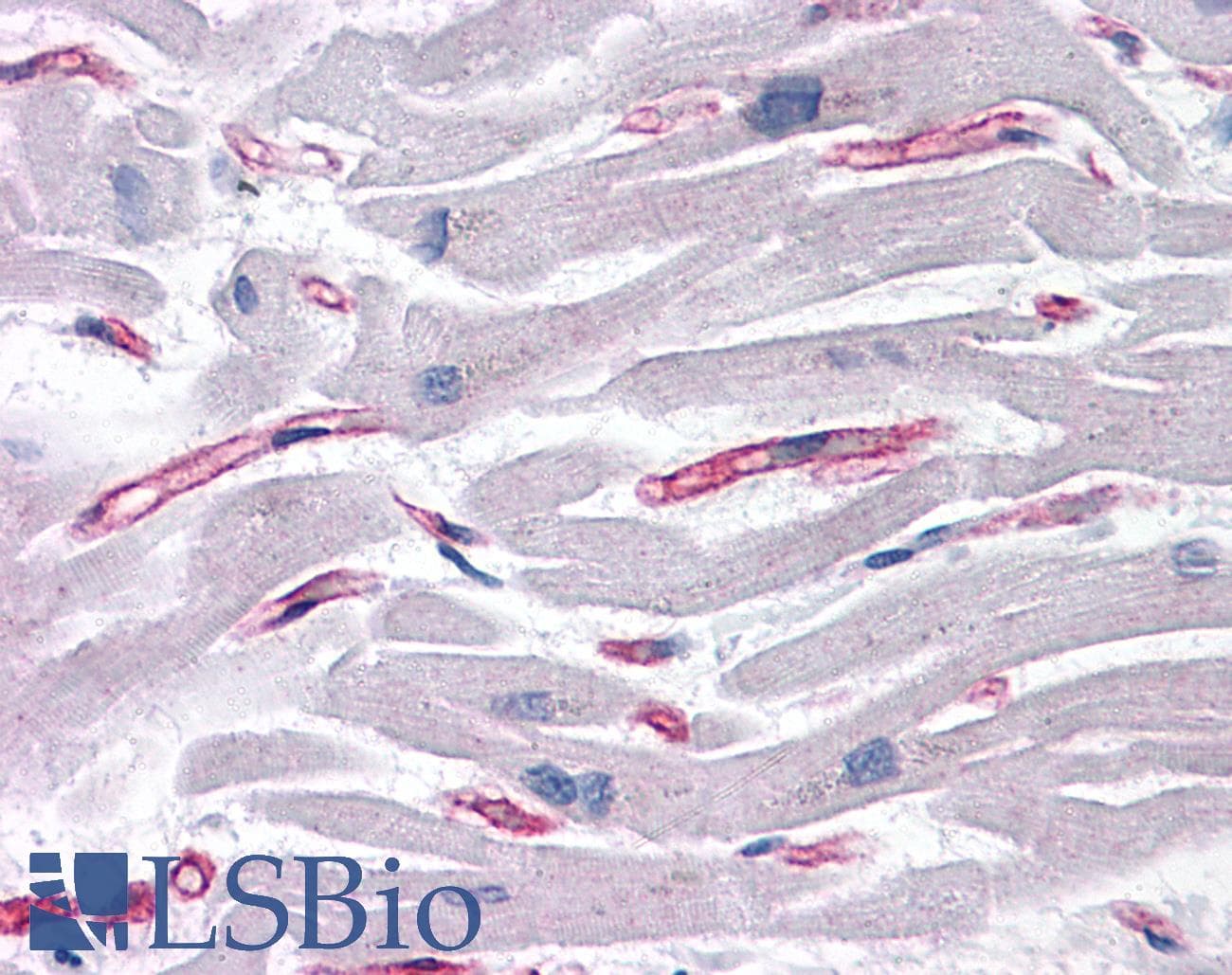 IHC-plus™ Polyclonal Rabbit anti-Human SLAIN1 Antibody (IHC)