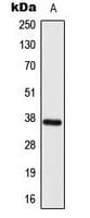 ELOVL4 Antibody (Internal)