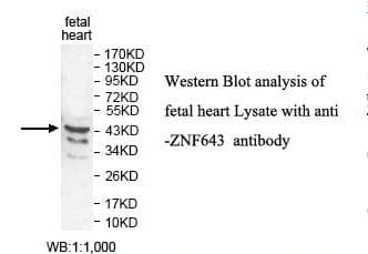 ZNF643 Antibody (aa56-308)